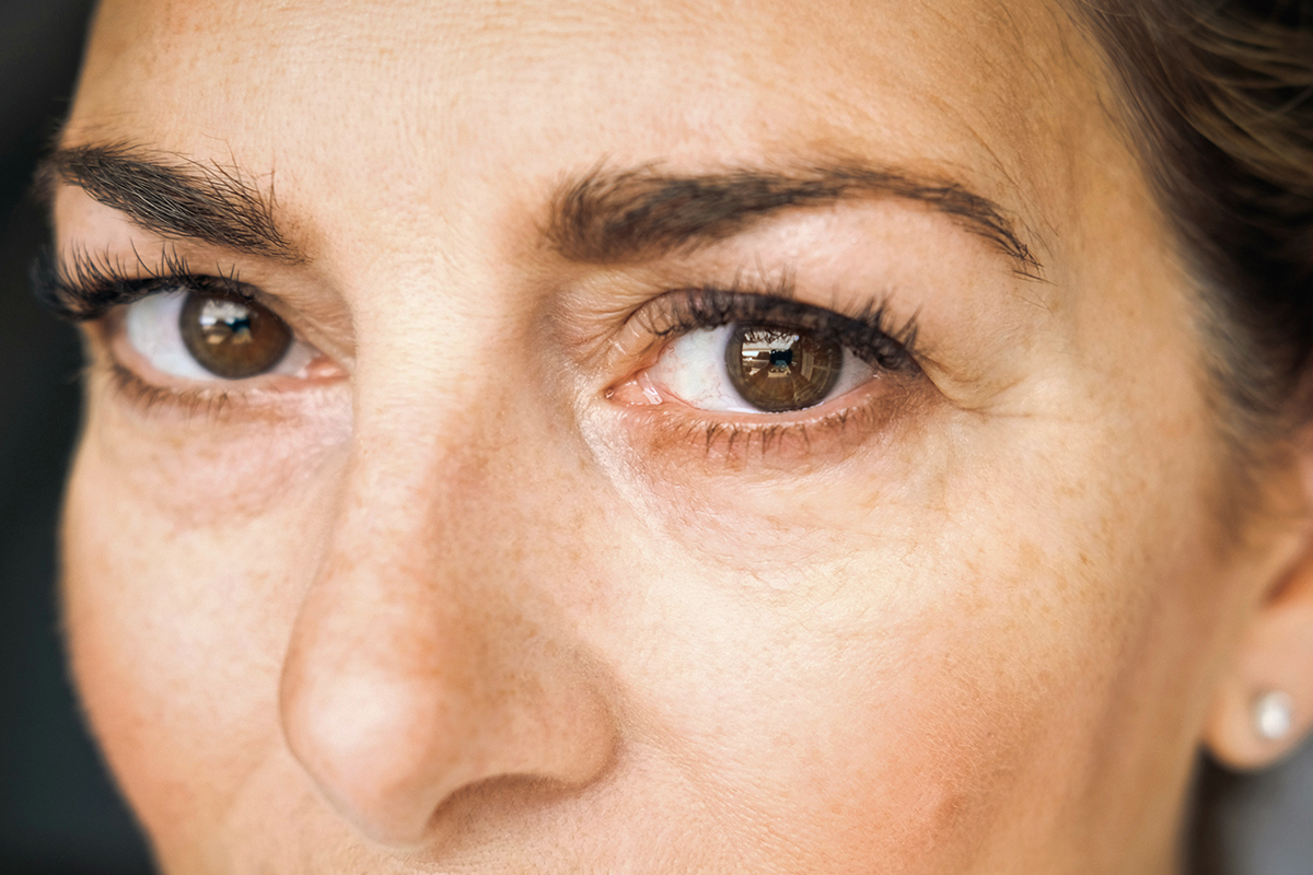 Anti-Aging: Hilfe bei Tränensäcken - Still Sparkling | Der Lifestyle